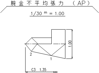 腕金応力図